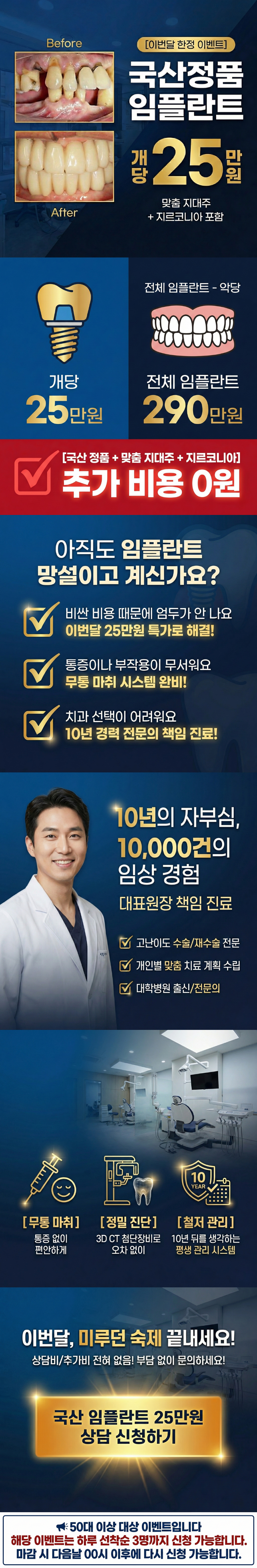 전국 임플란트 25만원 상담 안내